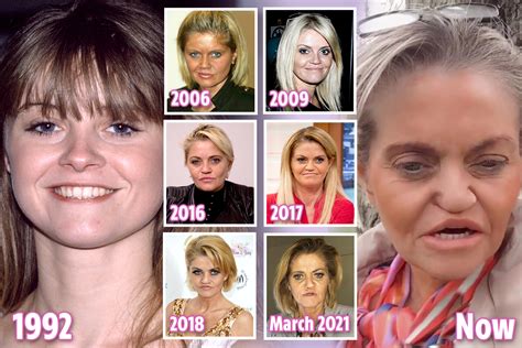 danniella westbrook 1999|danniella westbrook before and after.